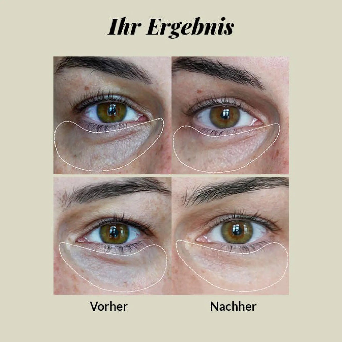Nordic Cosmetics Eye Cream